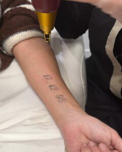 detataouage montpellier