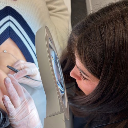 électrolyse Montpellier